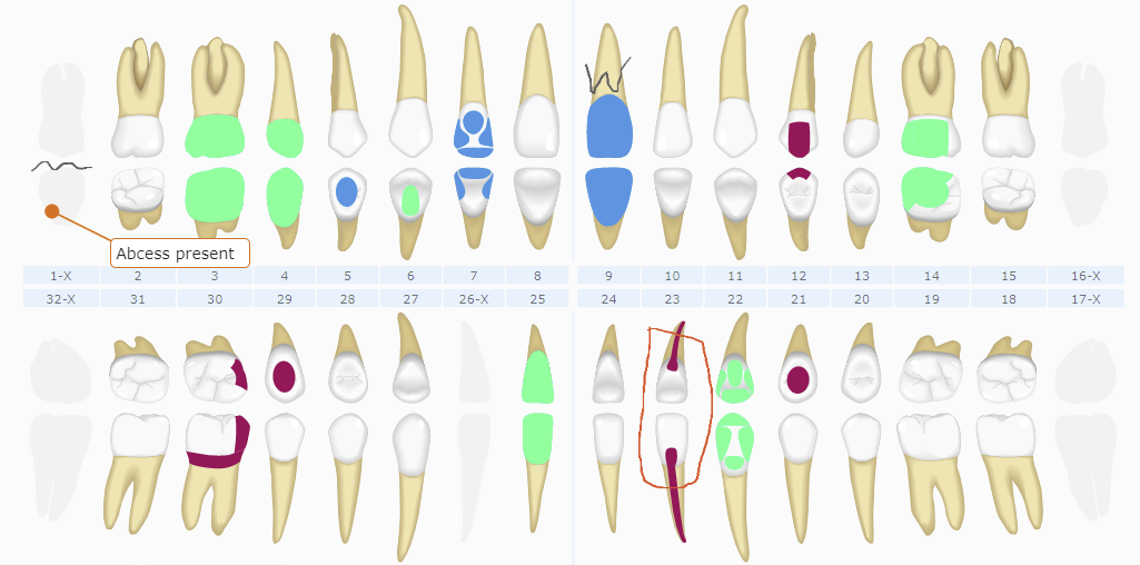 Curve Dental Unveils New Charting Module!